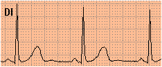 DI_mill.gif (2963 byte)