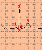 onde123.gif (2481 byte)